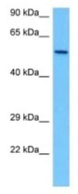 BBS4 Rabbit anti-Human, Polyclonal, Novus Biologicals 100 &mu;g | Buy Online | Novus Biologicals | Fisher Scientific